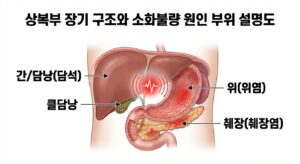 상복부 장기 구조와 소화불량 원인 부위 설명도