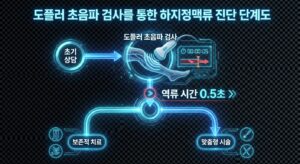 도플러 초음파 검사를 통한 하지정맥류 진단 단계도